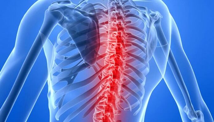 Οι παθολογίες της σπονδυλικής στήλης είναι οι πιο συχνές αιτίες πόνου στην πλάτη στην περιοχή της ωμοπλάτης