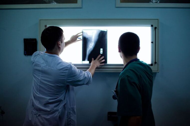 Διάγνωση της αρθρίδας σε x -ray